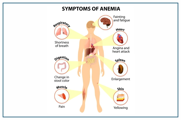 anaemia