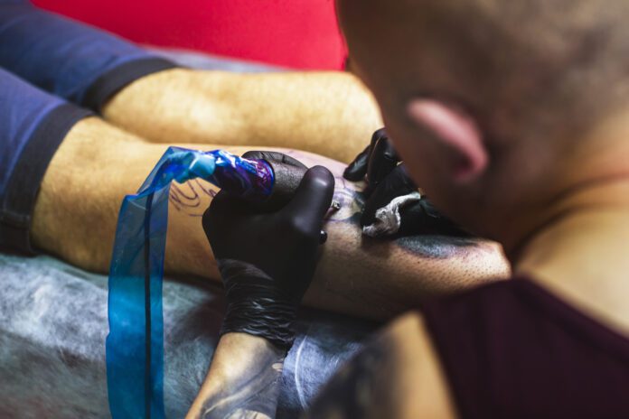 Tattoo Removal
